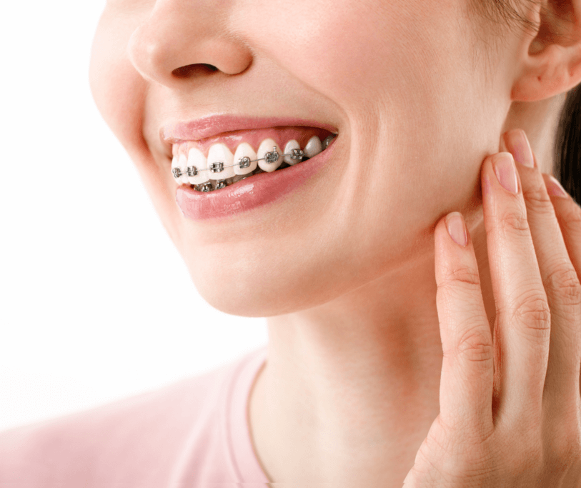 Metal Braces Effectiveness