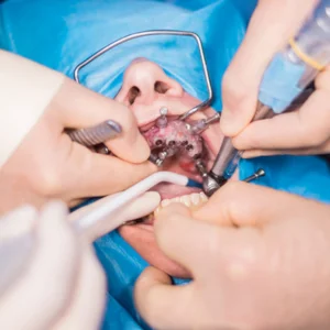 Oral & Maxillofacial Surgery