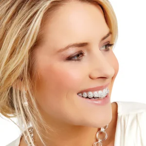 Radiance Brackets
