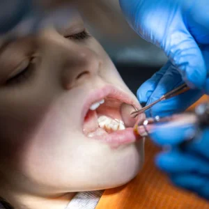 Surgical Orthodontics
