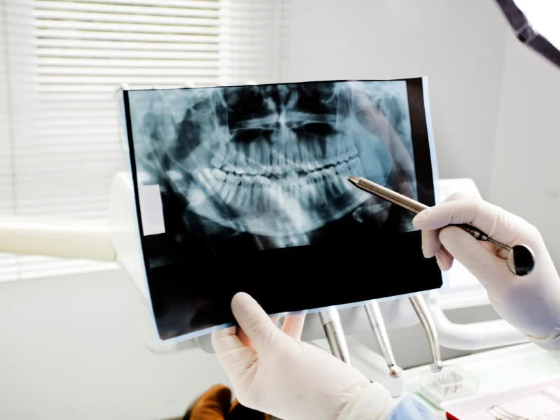 Understanding Oral and Maxillofacial Surgery